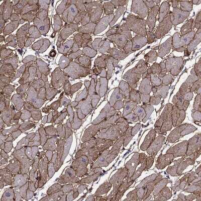 Immunohistochemistry-Paraffin: Laminin S/Laminin beta 2 Antibody (CL2979) [NBP2-42387]