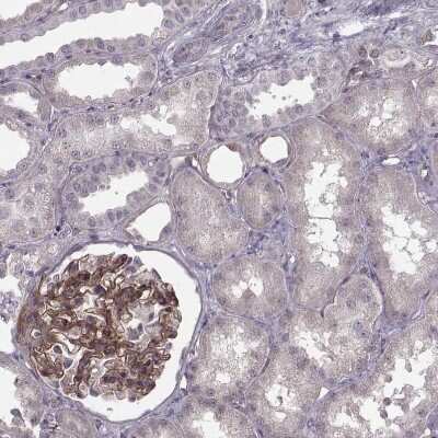 Immunohistochemistry-Paraffin: Laminin S/Laminin beta 2 Antibody (CL2979) [NBP2-42387]