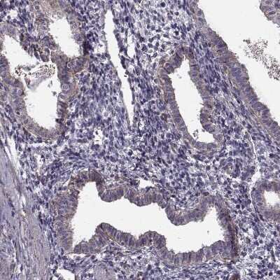 Immunohistochemistry-Paraffin: Laminin S/Laminin beta 2 Antibody (CL2979) [NBP2-42387]