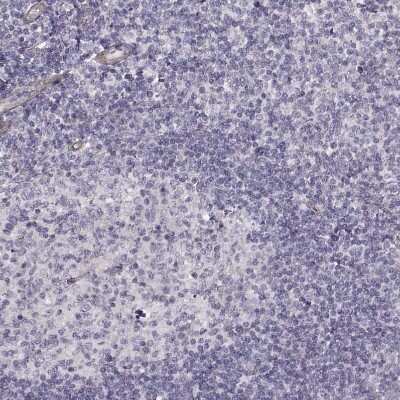 Immunohistochemistry-Paraffin: Laminin S/Laminin beta 2 Antibody (CL2979) [NBP2-42387]