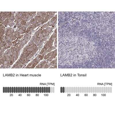 Immunohistochemistry-Paraffin: Laminin S/Laminin beta 2 Antibody (CL2979) [NBP2-42387]