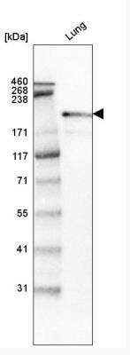 Western Blot: Laminin S/Laminin beta 2 Antibody (CL2979) [NBP2-42387]