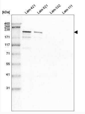 Western Blot: Laminin S/Laminin beta 2 Antibody (CL2979) [NBP2-42387]