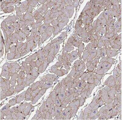 Immunohistochemistry-Paraffin: Laminin S/Laminin beta 2 Antibody [NBP1-87717]