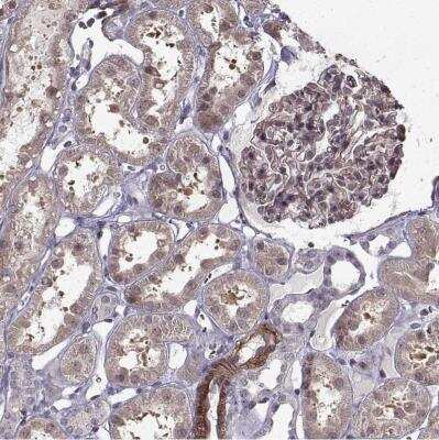 Immunohistochemistry-Paraffin: Laminin S/Laminin beta 2 Antibody [NBP1-87717]