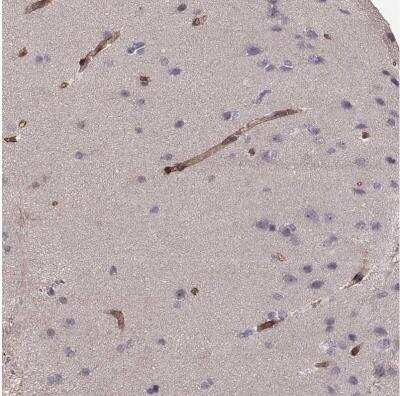Immunohistochemistry-Paraffin: Laminin S/Laminin beta 2 Antibody [NBP1-87717]