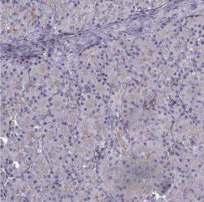 Immunohistochemistry-Paraffin: Laminin S/Laminin beta 2 Antibody [NBP1-87717]