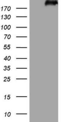 Western Blot: Laminin S/Laminin beta 2 Antibody (OTI3B4)Azide and BSA Free [NBP2-71114]