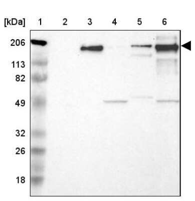 Western Blot: Laminin S/Laminin beta 2 Antibody [NBP1-87717]