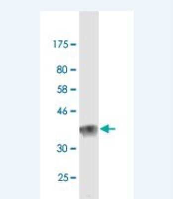 Western Blot: Laminin alpha 2 Antibody (1A7) [H00003908-M02]