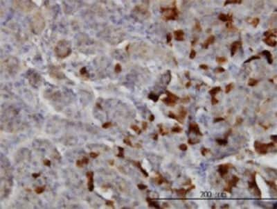 Immunohistochemistry-Paraffin: Laminin alpha 2 Antibody (2D4) [H00003908-M01]