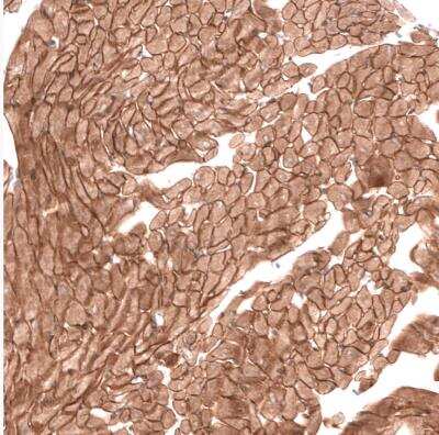 Immunohistochemistry-Paraffin: Laminin alpha 2 Antibody (CL3450) [NBP2-46624]