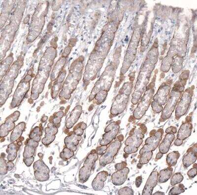 Immunohistochemistry-Paraffin: Laminin alpha 2 Antibody (CL3450) [NBP2-46624]