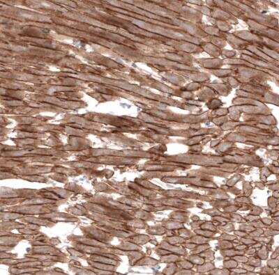 Immunohistochemistry-Paraffin: Laminin alpha 2 Antibody (CL3450) [NBP2-46624]