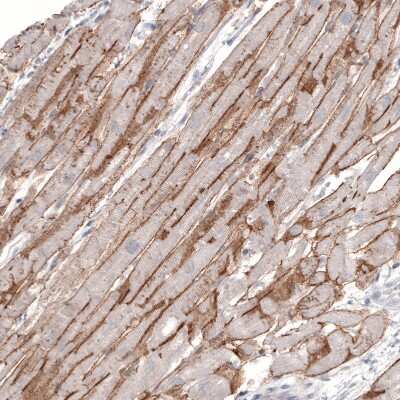 Immunohistochemistry-Paraffin: Laminin alpha 2 Antibody (CL3450) [NBP2-46624]