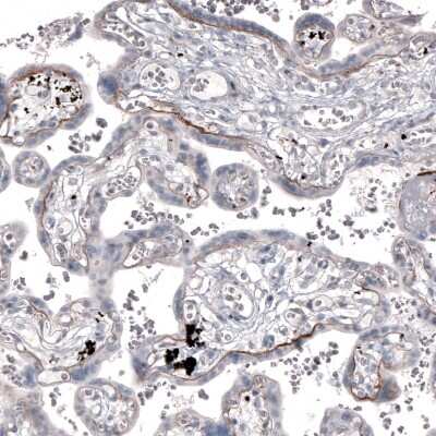 Immunohistochemistry-Paraffin: Laminin alpha 2 Antibody (CL3450) [NBP2-46624]