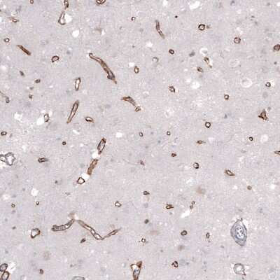 Immunohistochemistry-Paraffin: Laminin alpha 2 Antibody (CL3450) [NBP2-46624]
