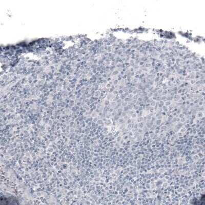 Immunohistochemistry-Paraffin: Laminin alpha 2 Antibody (CL3450) [NBP2-46624]
