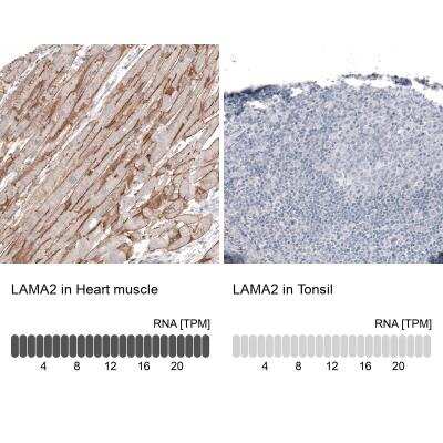 Immunohistochemistry-Paraffin: Laminin alpha 2 Antibody (CL3450) [NBP2-46624]