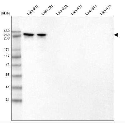 Western Blot: Laminin alpha 2 Antibody (CL3450) [NBP2-46624]