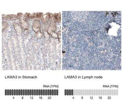 Immunohistochemistry-Paraffin: Laminin alpha 3 Antibody (CL3112) [NBP2-42390]