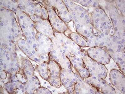 Immunohistochemistry: Laminin alpha 4 Antibody (OTI5G8) [NBP2-45582]