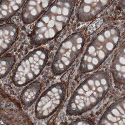 Immunohistochemistry-Paraffin: Laminin alpha 4 Antibody (CL3183) [NBP2-42392]