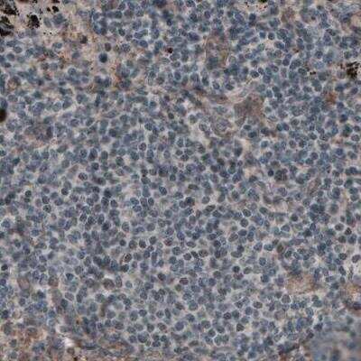 Immunohistochemistry-Paraffin: Laminin alpha 4 Antibody (CL3183) [NBP2-42392]