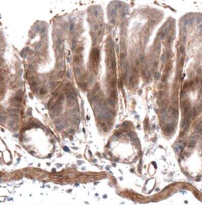 Immunohistochemistry-Paraffin: Laminin alpha 4 Antibody (CL3183) [NBP2-42392]