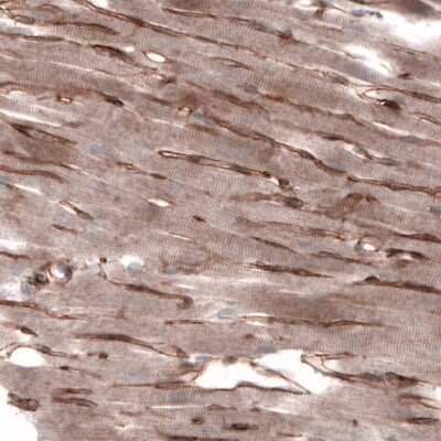 Immunohistochemistry-Paraffin: Laminin alpha 4 Antibody (CL3183) [NBP2-42392]