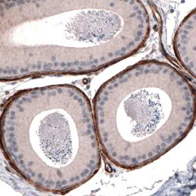 Immunohistochemistry-Paraffin: Laminin alpha 4 Antibody (CL3183) [NBP2-42392]
