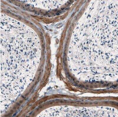 Immunohistochemistry-Paraffin: Laminin alpha 4 Antibody (CL3183) [NBP2-42392]