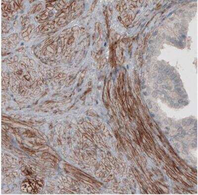 Immunohistochemistry-Paraffin: Laminin alpha 4 Antibody (CL3183) [NBP2-42392]