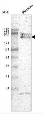 Western Blot: Laminin alpha 4 Antibody (CL3183) [NBP2-42392]