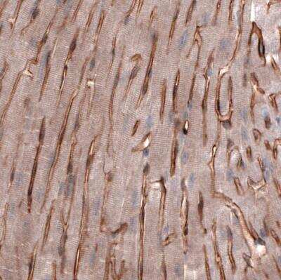 Immunohistochemistry-Paraffin: Laminin alpha 4 Antibody (CL3185) [NBP2-42393]