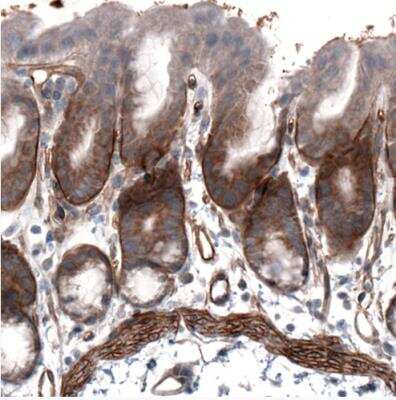 Immunohistochemistry-Paraffin: Laminin alpha 4 Antibody (CL3185) [NBP2-42393]