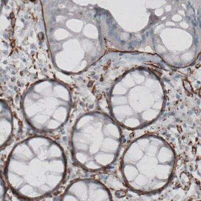 Immunohistochemistry-Paraffin: Laminin alpha 4 Antibody (CL3185) [NBP2-42393]