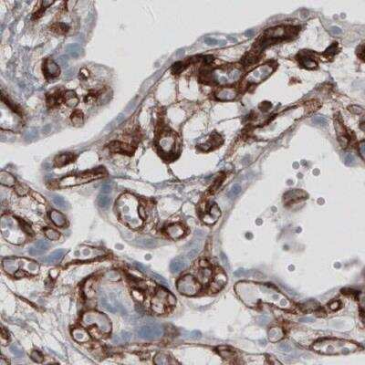 Immunohistochemistry-Paraffin: Laminin alpha 4 Antibody (CL3185) [NBP2-42393]