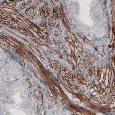 Immunohistochemistry-Paraffin: Laminin alpha 4 Antibody (CL3185) [NBP2-42393]