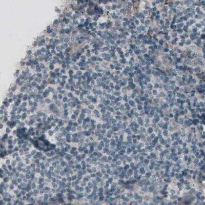 Immunohistochemistry-Paraffin: Laminin alpha 4 Antibody (CL3185) [NBP2-42393]