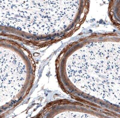 Immunohistochemistry-Paraffin: Laminin alpha 4 Antibody (CL3185) [NBP2-42393]