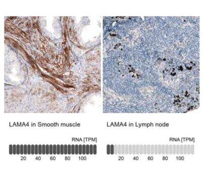 Immunohistochemistry-Paraffin: Laminin alpha 4 Antibody (CL3185) [NBP2-42393]