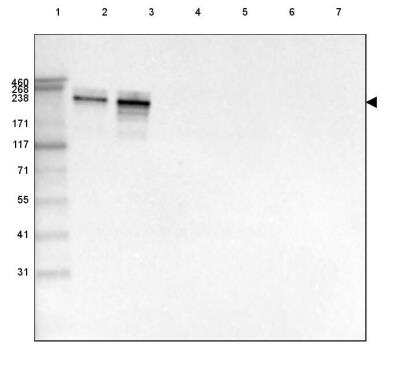 Western Blot: Laminin alpha 4 Antibody (CL3185) [NBP2-42393]