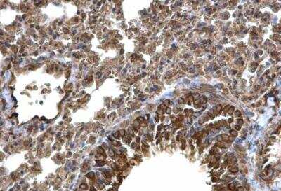 Immunohistochemistry-Paraffin: Laminin alpha 4 Antibody [NBP1-32159]