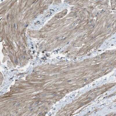 Immunohistochemistry-Paraffin: Laminin alpha 4 Antibody [NBP1-87716]