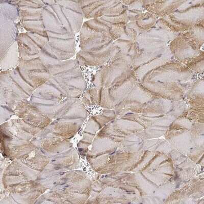 Immunohistochemistry-Paraffin: Laminin alpha 4 Antibody [NBP1-87716]
