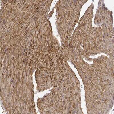 Immunohistochemistry-Paraffin: Laminin alpha 4 Antibody [NBP1-87716]