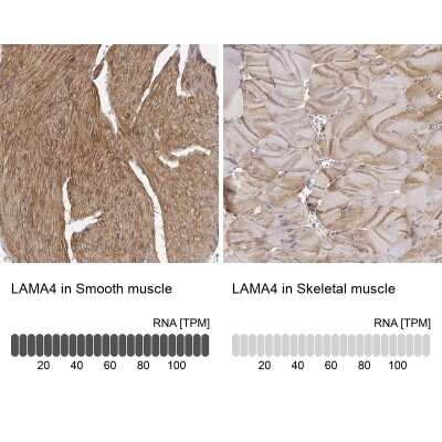 Immunohistochemistry-Paraffin: Laminin alpha 4 Antibody [NBP1-87716]