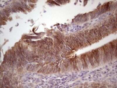 Immunohistochemistry: Laminin alpha 4 Antibody (OTI5G8) - Azide and BSA Free [NBP2-71113]