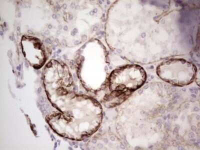 Immunohistochemistry: Laminin alpha 4 Antibody (OTI5G8) - Azide and BSA Free [NBP2-71113]